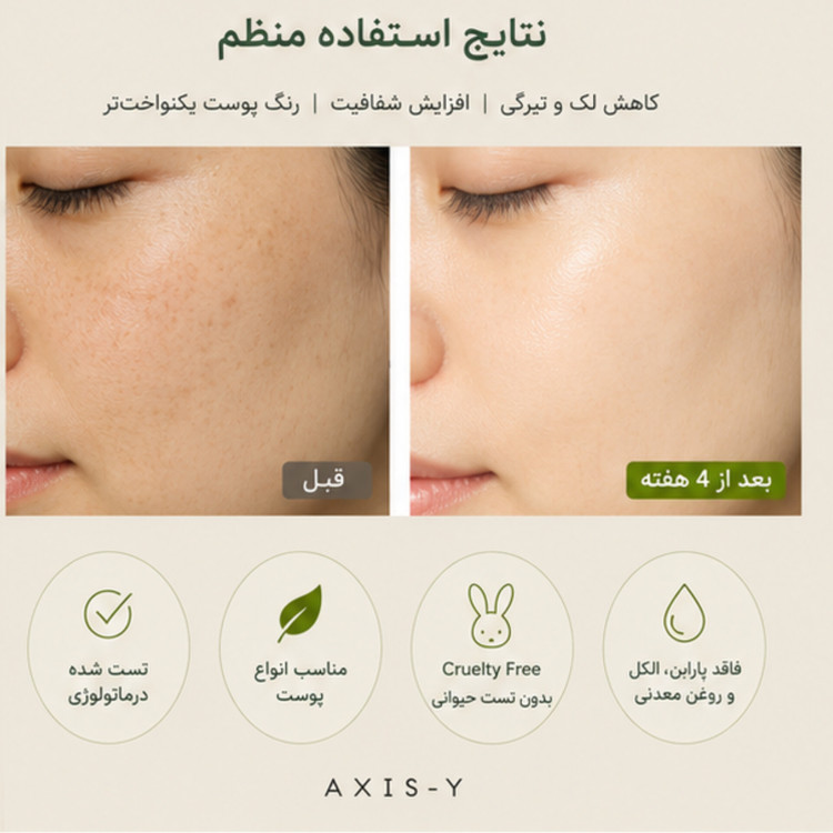 کرم روشنکننده اکسیس وای TXA 2.5% حجم 50 میلیلیتر